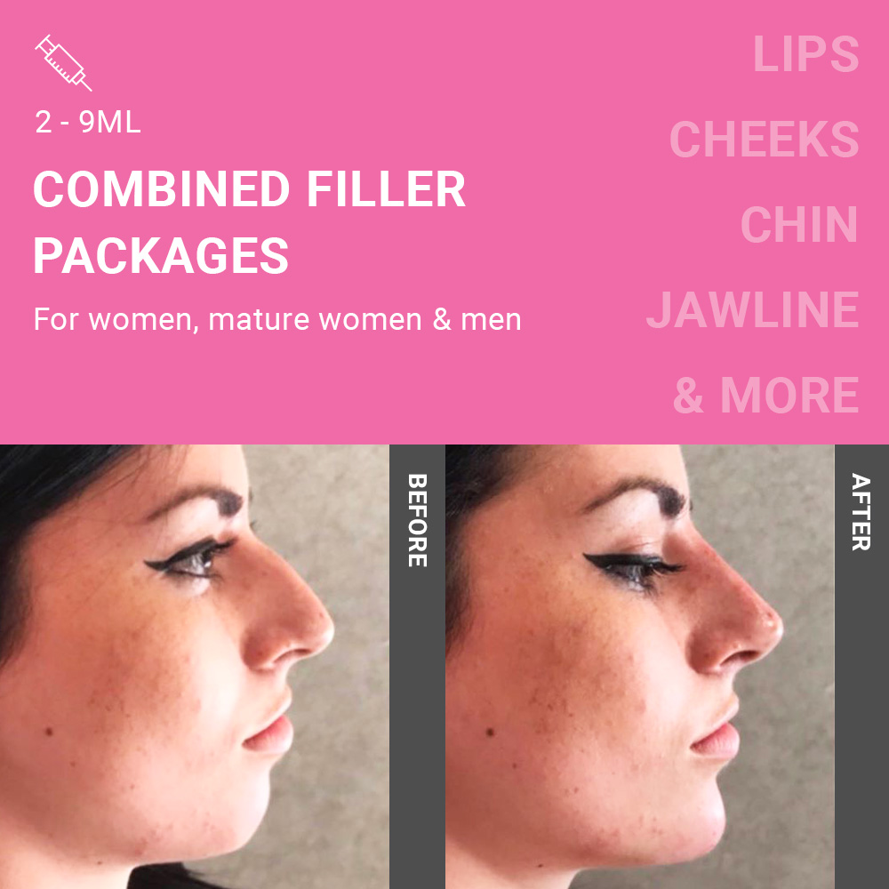 Package filler clearance
