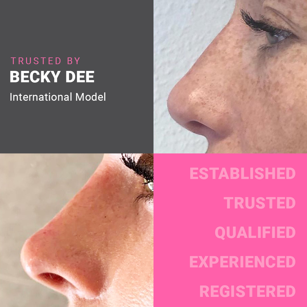 Non-Surgical Nose Correction